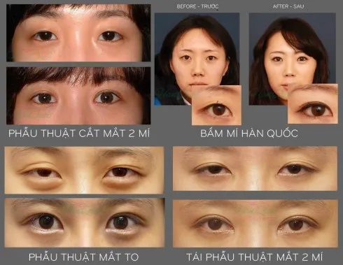 Mắt hai mí là chuẩn mực của sắc đẹp châu Á.