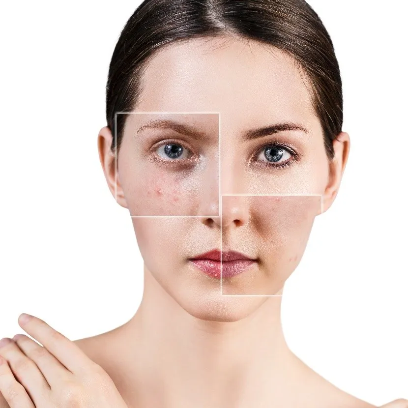 các vấn đề về da - elle vietnam 6