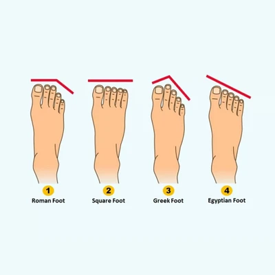 Trắc nghiệm hình dáng ngón chân