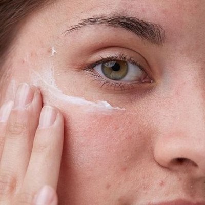 Chăm sóc da khi mắc Hội chứng buồng trứng đa nang PCOS