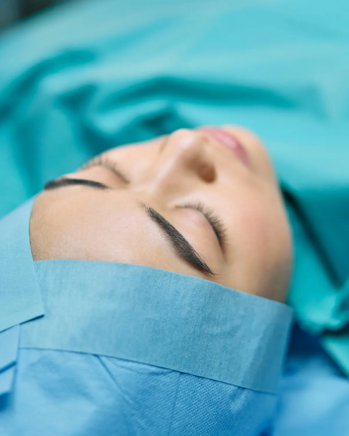 bao lâu mí mắt hồi phục sau khi cắt chỉ