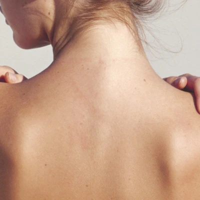 sản phẩm trị mụn lưng hình ft