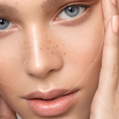 Cách trị mụn-Cô gái áp tay lên mặt.