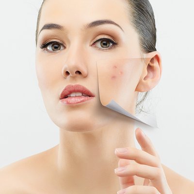 nguyên nhân gây mụn ft d