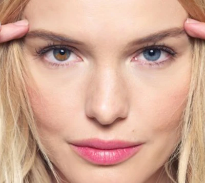 4 điểm lợi bất cập hại từ phẫu thuật thẩm mỹ