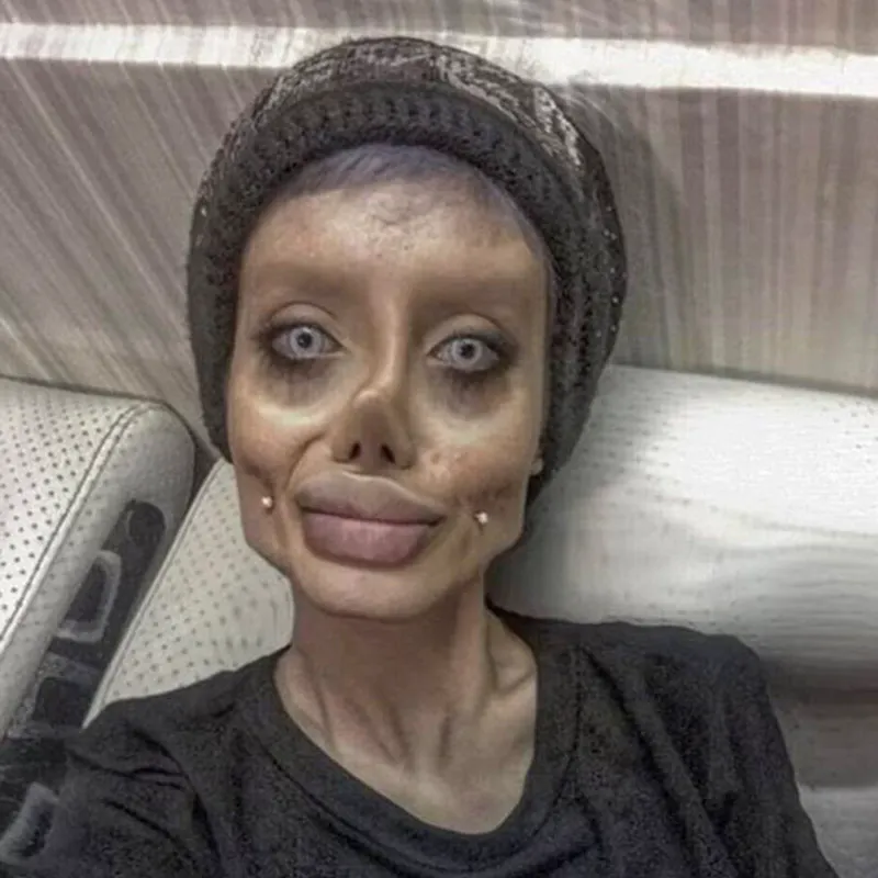 Nổi tiếng sau 50 lần phẫu thuật thẩm mỹ để trở thành Angelina Jolie