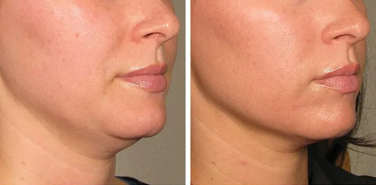 các vấn đề về da - elle vietnam 3