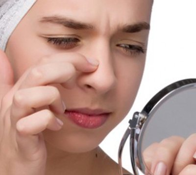 3 công thức mặt nạ trị mụn cám