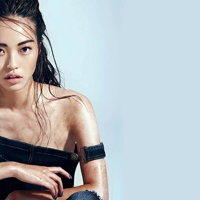 Viết cho làn da bị mụn: Bạn đang được hưởng một đặc ân cực kỳ lớn
