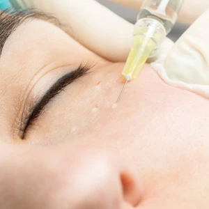 10 ngày cận tết - chăm sóc da cấp tốc cho năm Quý Mão đẹp rạng ngời