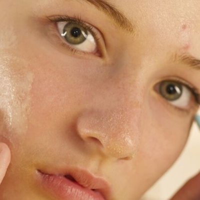 Cách trị mụn-Cô gái chạm tay lên mặt.