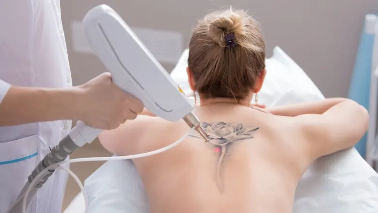 10 lý do mà bạn nên xem xét kỹ trước khi xăm mình