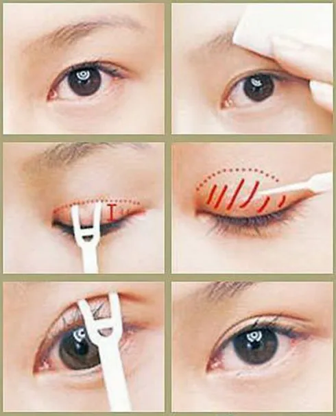 Keo kích mí <mark class=