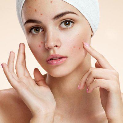 cách trị sẹo mụn cho làn da sáng ft