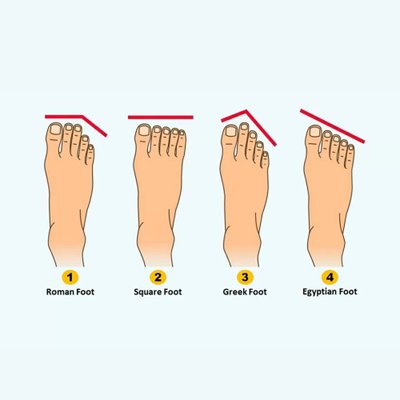Trắc nghiệm hình dáng ngón chân