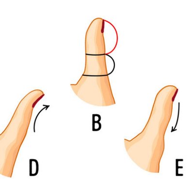 Hình dạng ngón tay cái tiết lộ điều gì về tính cách con người bạn
