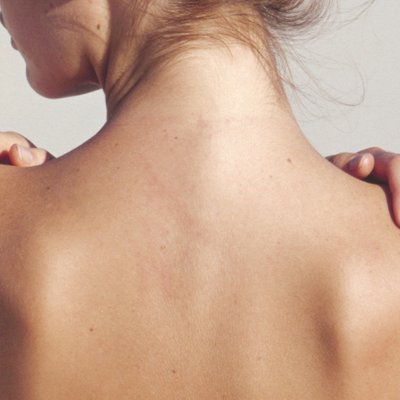 sản phẩm trị mụn lưng hình ft
