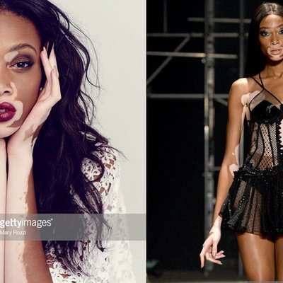 [Điểm tin thời trang] Người mẫu Winnie Harlow sẽ diễn trong Victoria's Secret show, Burberry ngưng sử dụng da thật