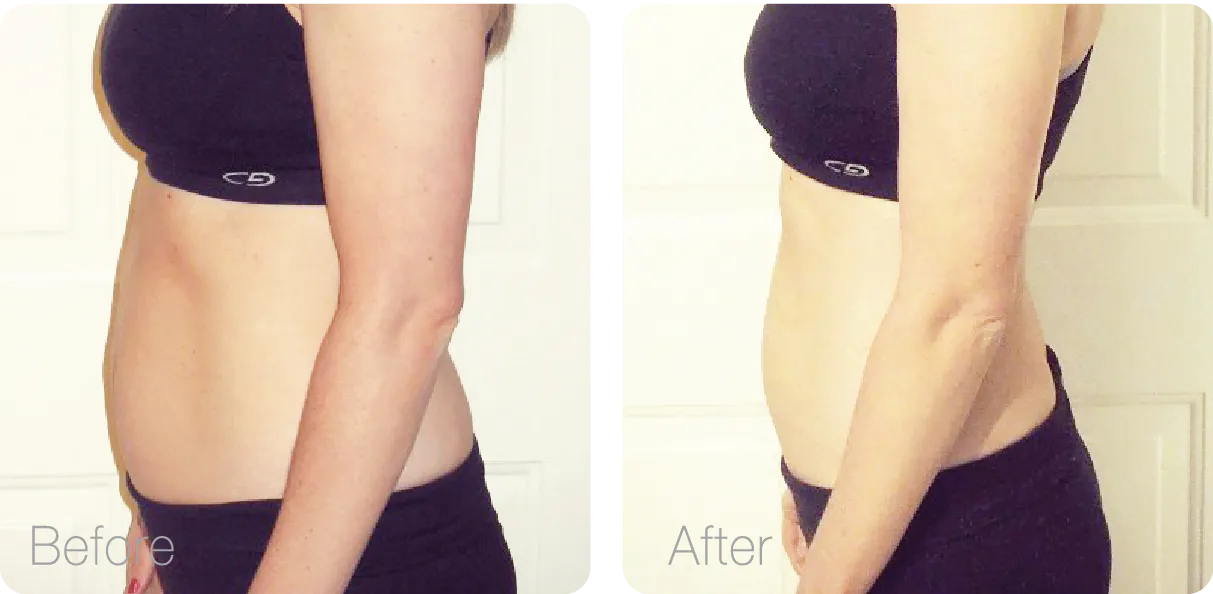 các vấn đề về da - elle vietnam 5