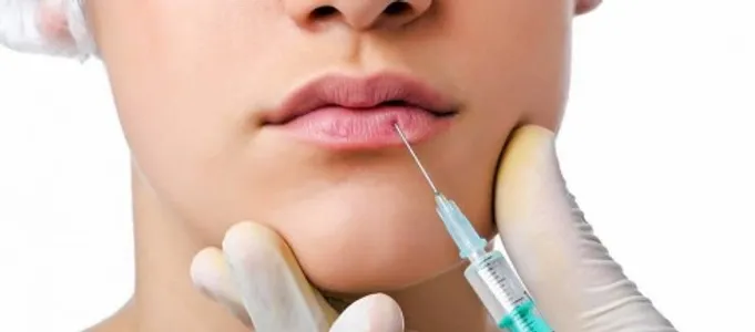 Môi hạt đậu - xu hướng mới hiệu nay